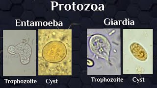 microscopical exam Protozoal trophozoites amp cysts [upl. by Goldia384]