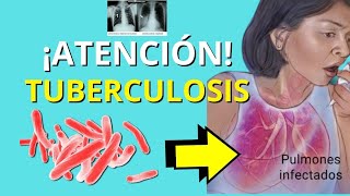 ✅TUBERCULOSIS PULMONAR🫁 Fisiopatología microbiologia signos y síntomas diagnóstico y tratamiento [upl. by Alik142]