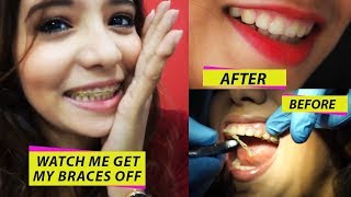 WATCH ME GET MY BRACES OFF amp THE DRASTIC CHANGE IN MY TEETH [upl. by Rogerg774]