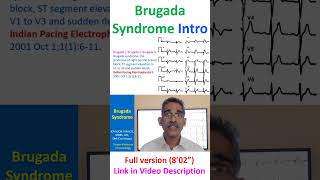 Brugada Syndrome [upl. by Bohner]