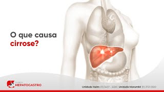 O que causa cirrose  Clínica Hepatogastro [upl. by Jochbed]