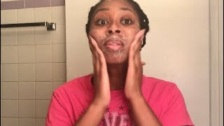 Glycolic Acid Peel DIY  Dark Spot Treatment [upl. by Kennet740]