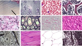 Practice Identifying Connective Tissue Complete [upl. by Decato]