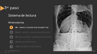 Radiografía de Abdomen Paso a Paso [upl. by Epilif76]