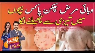 Chickenpox in Children  Symptoms Diagnosis and Treatment  Watch video [upl. by Marisa]