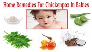 How To Deal With Chickenpox In Babies With Natural Home Remedies [upl. by Ruckman959]