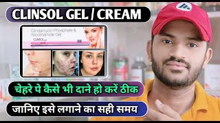 Clinsol gel how to use full review in hindi [upl. by Anhaj860]