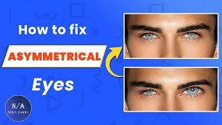 How To Fix Asymmetrical Eyes   Looksmaxxing Guide blackpill [upl. by Proudlove]