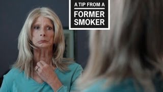 CDC Tips From Former Smokers  Terrie H’s Tip Ad [upl. by Dolhenty]