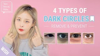 How to Remove Dark Circles Under Eyes In The Most Effective Way  Teen Beauty Bible [upl. by Nimajeb]