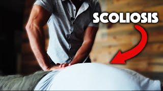 Man With SCOLIOSIS Gets HUGE Chiropractic CRACK Relief [upl. by Akimot111]