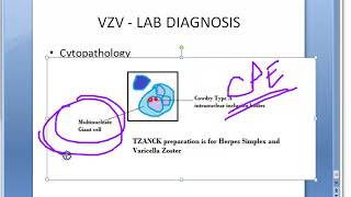 Microbiology 457 c Chicken Pox VZV Varicella Zoster Virus Lab Diagnosis TZANCK smear Giant cell [upl. by Leila]