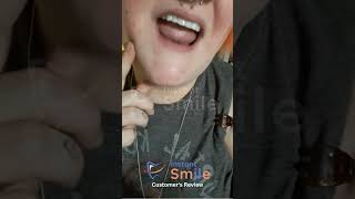 Kayla Patterson ❤️ Instant Smile Teeth Veneers 😁 Customers Review 2023 [upl. by Ikcin708]