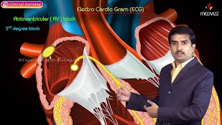 CVS Physiology USMLE Step 1  Cardiac Output and its regulation Systolic and diastolic murmurs [upl. by Laurence]