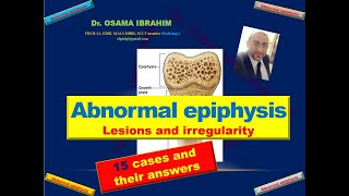 Abnormal epiphysis 15 cases with their answers [upl. by Daenis]