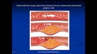 Cellular Adaptations  Definition Classification Mechanisms amp Examples [upl. by Atalie]