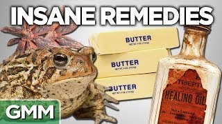 10 Insane Old Time Remedies [upl. by Jews428]