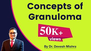 Granuloma by Dr Devesh Mishra [upl. by Nosduj]