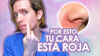 DERMATITIS SEBORREICA Qué es y cómo se trata  Recomendaciones de un dermatologo [upl. by Kajdan]