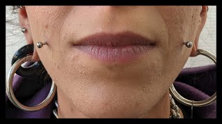 Cheek Piercing Procedure  SKART Lab TERNI [upl. by Jelene741]