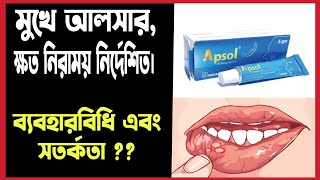 মুখের আলসার দূর করে যে মেডিসিন Apsol oral pest Review bangla  Apthous Ulcer Treatment Bangla [upl. by Okiek]