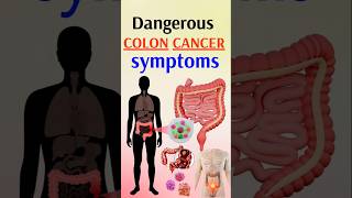 Cancer Symptoms You Should NEVER Ignore [upl. by Scrivings505]