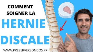 Comment Soigner la Hernie Discale  SANS OPÉRATION et SANS MÉDICAMENT [upl. by Oiluj707]