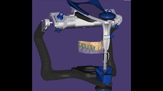 Design bridge from 12 to17 with articulator adjust [upl. by Broek]