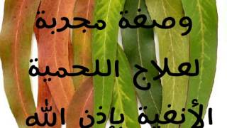 وصفة مجربة لعلاج اللحمية الأنفيةالجلود بدون عملية جراحية بإذن الله [upl. by Loralyn771]