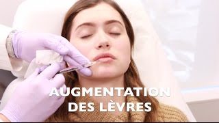 MES INJECTIONS AUX LÈVRES [upl. by Groeg]