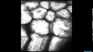 Confocal Endomicroscopy of the Stomach Gastritis Int Metaplasia Adenoma and Gastric Cancer [upl. by True]