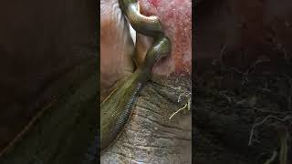 Leech therapy in management of diabetic wound [upl. by Sancha]