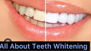 “Know All About Teeth Whitening “ [upl. by Oilla]