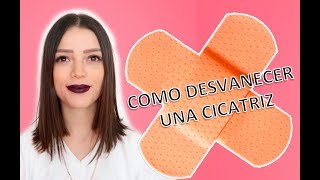 ¿Cómo desvanecer una cicatriz Cicatricure funciona  Story Time  Lylocyv [upl. by Leasia201]