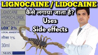 Lidocain injection  Lignocain injection  Lox 2 injection  xylocaine injection uses side effects [upl. by Milton]