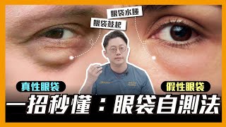 眼袋自測法！一秒搞懂「真性眼袋」vs「假性眼袋」｜周杰醫師 [upl. by Yenrab]