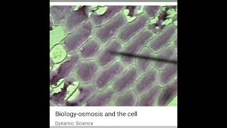 Osmosis 📝 l Plasmolysis and Deplasmolysis👍 viral botanysolution4054 [upl. by Agna]