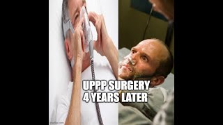 UPPP SURGERY 4 YEARS LATER [upl. by Raf]