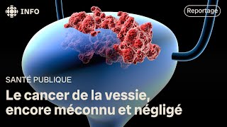 Le cancer de la vessie encore méconnu et négligé [upl. by Harms]