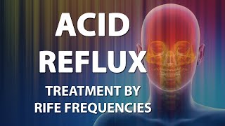 Acid Reflux GERD  RIFE Frequencies Treatment  Energy amp Quantum Medicine with Bioresonance [upl. by Ebag]