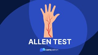 Allen Test [upl. by Derej]