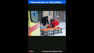 Decorticate vs Decerebrate Posturing Differences ExplainedShorts [upl. by Blayne]