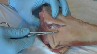 Suture  Basic Technique 1 [upl. by Orravan]