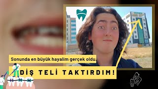 Diş teli taktırdım🦷 En büyük hayalim gerçek oldu  ilk 24 saatlik deneyimim  ücreti ne Yeni Vlog✅ [upl. by Holt]