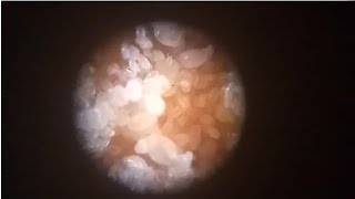 ÁCAROS como nunca los habías visto AL MICROSCOPIO [upl. by Assirral58]