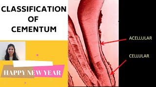 CEMENTUM  PART II II Classification of Cementum [upl. by Avlasor]