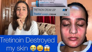 Quitting Tretinoin  Tretinoin destroyed my skin😭😫 [upl. by Airtemak124]