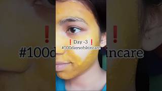 acne amp dark spot free skin day3 [upl. by Fital26]