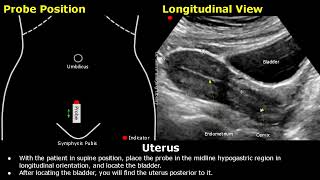 Uterus amp Ovaries Ultrasound Probe Positioning  Transducer Placement  Gynecological USG Scanning [upl. by Alger]