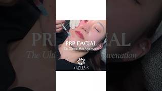 PRP FACIAL  SKIN CLINIC IN DUBAI Dubai dubaibeautyclinic uaeclinic skintreatment prpfacial [upl. by Jaye]